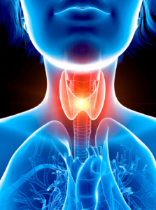 An anatomical illustration highlighting the thyroid gland in a human body with a focus on potential inflammation or disorder.